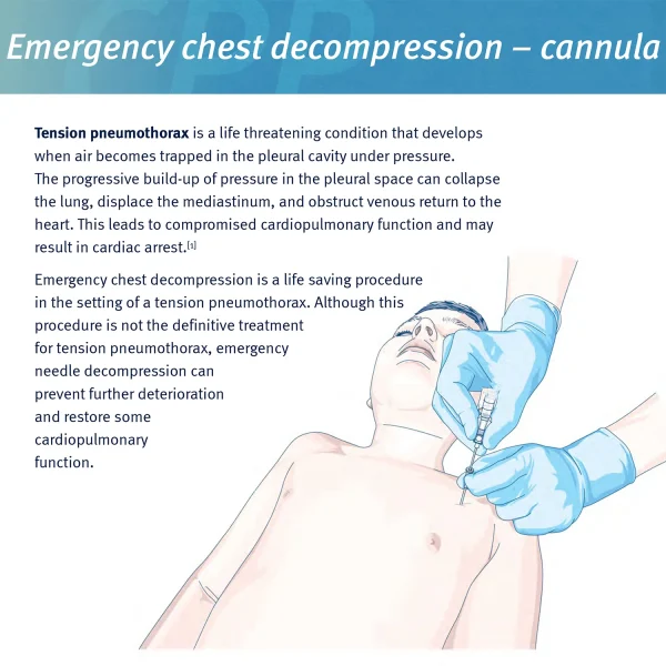 Sanke Rescue Pneumothorax Needle Trauma Medical Ifak Chest Cathether Needlecatheter 50g Needle Decompression Edc First Aid Kit - Image 5