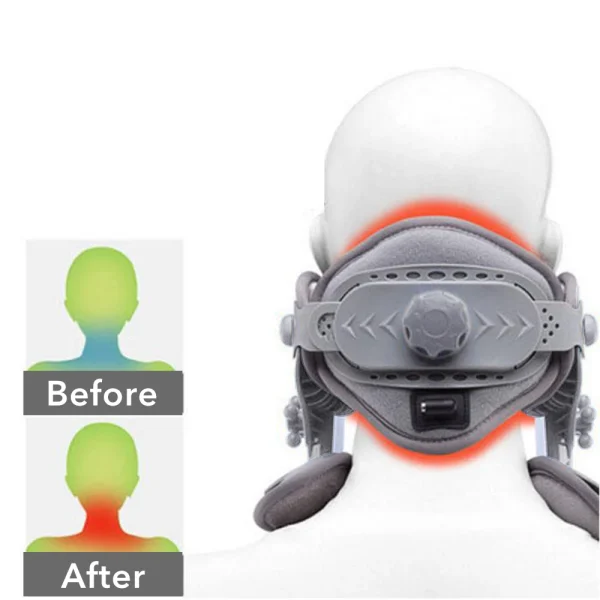 Medical Neck traction device Inflatable Cervical Collar Correction kit Neck Retractor Cervical Collar Stretcher Spine Pain Relif - Image 6